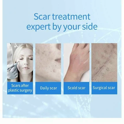 ครีมลดรอยแผลเป็น Scar removal gel ointment