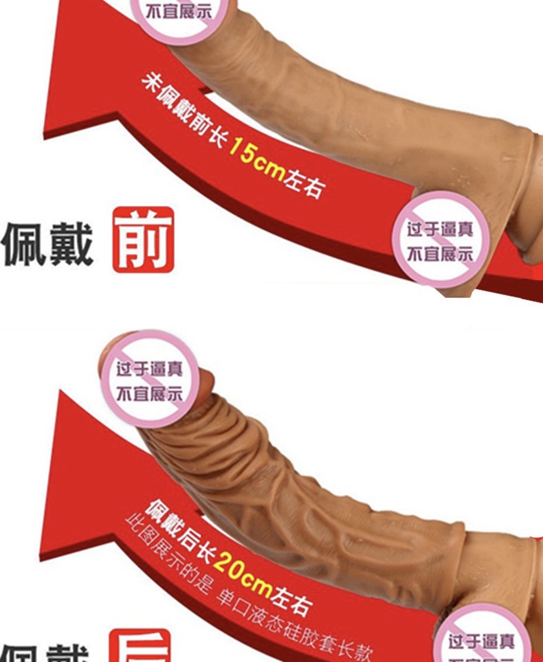 ปลอกเนื้อ (เสริม 3 แบบ)