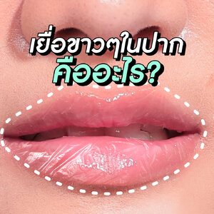 เยื่อขาวๆในปาก คืออะไร