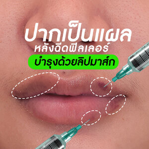 ปากเป็นแผล บำรุงด้วยลิปมาส์ก