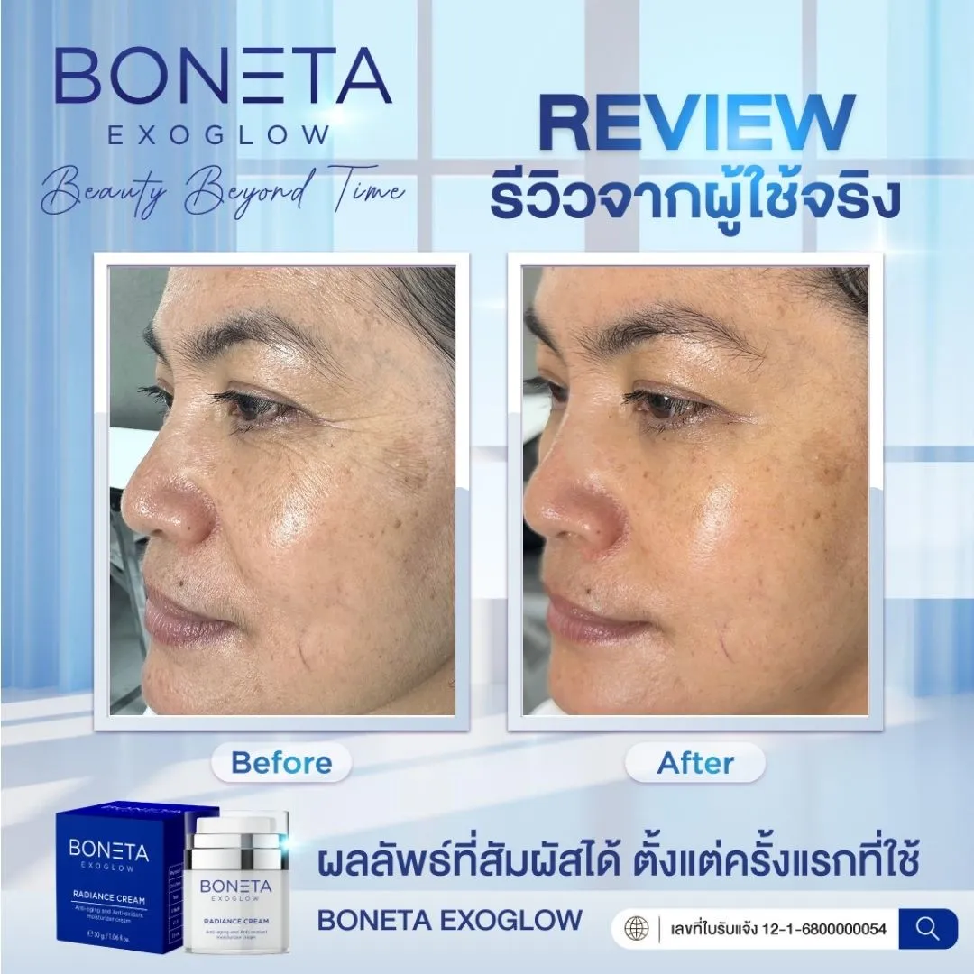 boneta exoglow โบเนต้า ครีมบำรุงผิวหน้า ขาวกระจ่างใส ลดริ้วรอย ยกกระชับใบหน้า