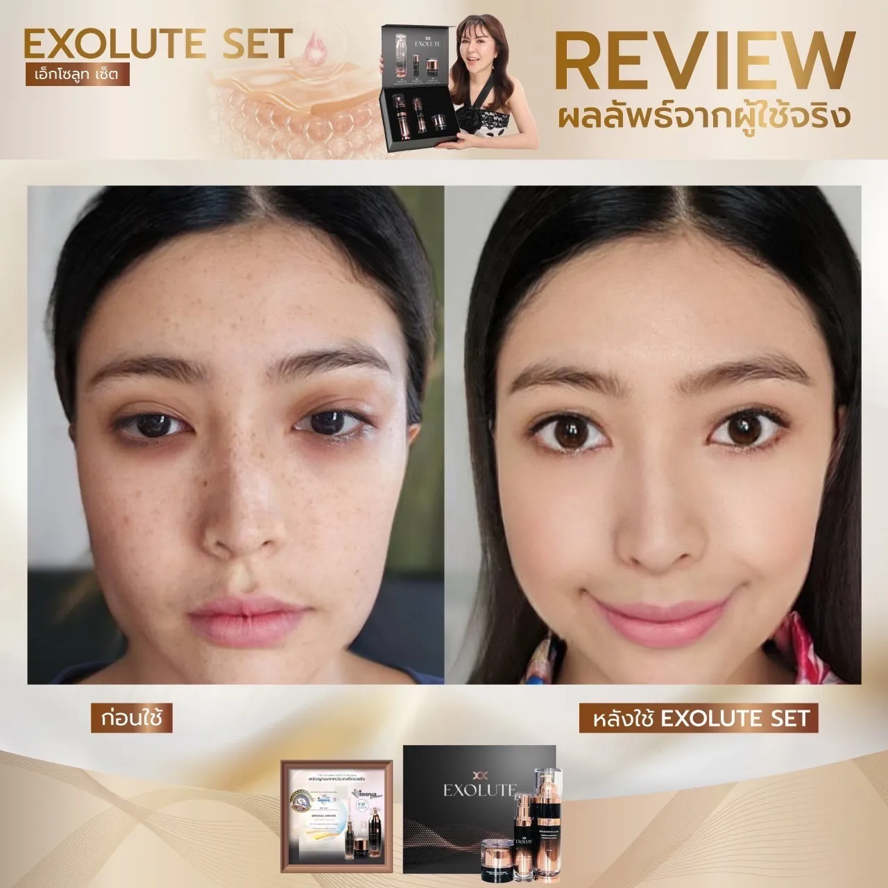 Exolute skin booster ultra ผิวกระจ่างใส บู๊สผิว ผิวเปล่งปลั่ง อ่อนเยาว์ Exolute complex multi serum ผิวชุ่มชื่น Exolute advance lifing filler cream ยกกระชับใบหน้า ลดริ้วรอย