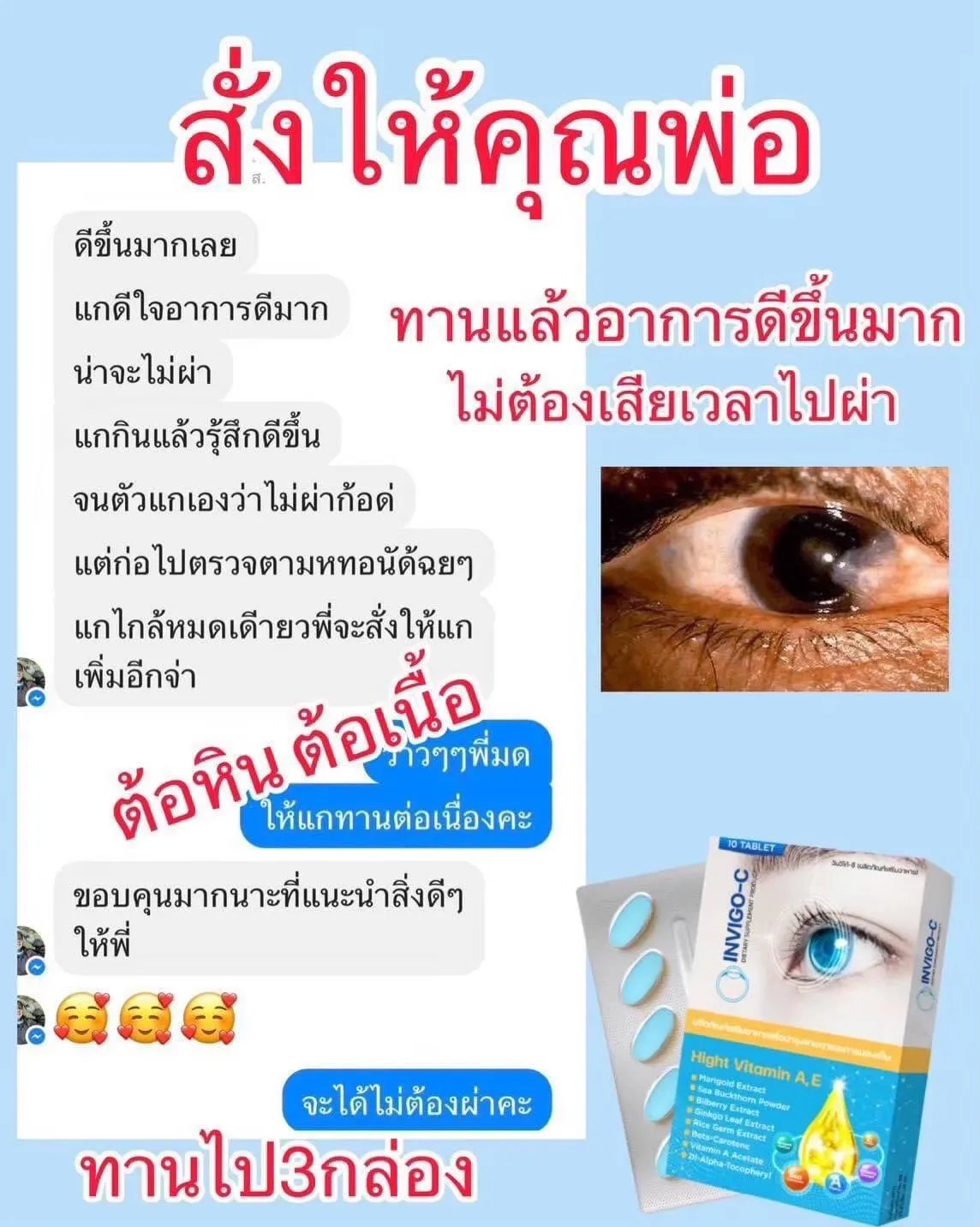 Invigoc อินวิโก้ซ๊ วิตามินบำรุงดวงตา วิตามินบำรุงสายตา ตาแห้ง แสบตา ตาพร่ามัว อาหารเสริมบำรุงดวงตา ต้อเนื้อ ต้อลม ต้อกระจก วิตามินบำรุงตายี่ห้อไหนดี ตาแห้งจากหน้าจอ วิตามินบำรุงตายี่ห้อไหนดี สายตาเสื่อมบำรุงยังไง