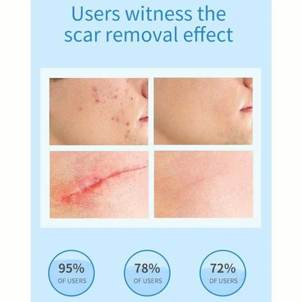 ครีมลดรอยแผลเป็น Scar removal gel ointment