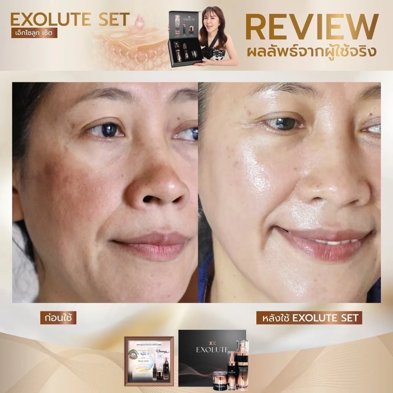 Exolute skin booster ultra ผิวกระจ่างใส บู๊สผิว ผิวเปล่งปลั่ง อ่อนเยาว์ Exolute complex multi serum ผิวชุ่มชื่น Exolute advance lifing filler cream ยกกระชับใบหน้า ลดริ้วรอย